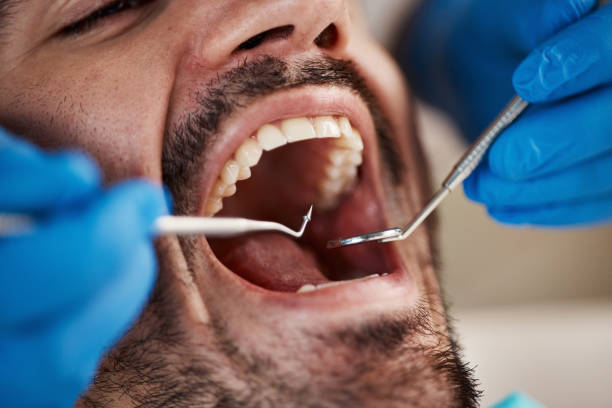 Best Broken or Chipped Tooth Repair in Cross Plains, TN